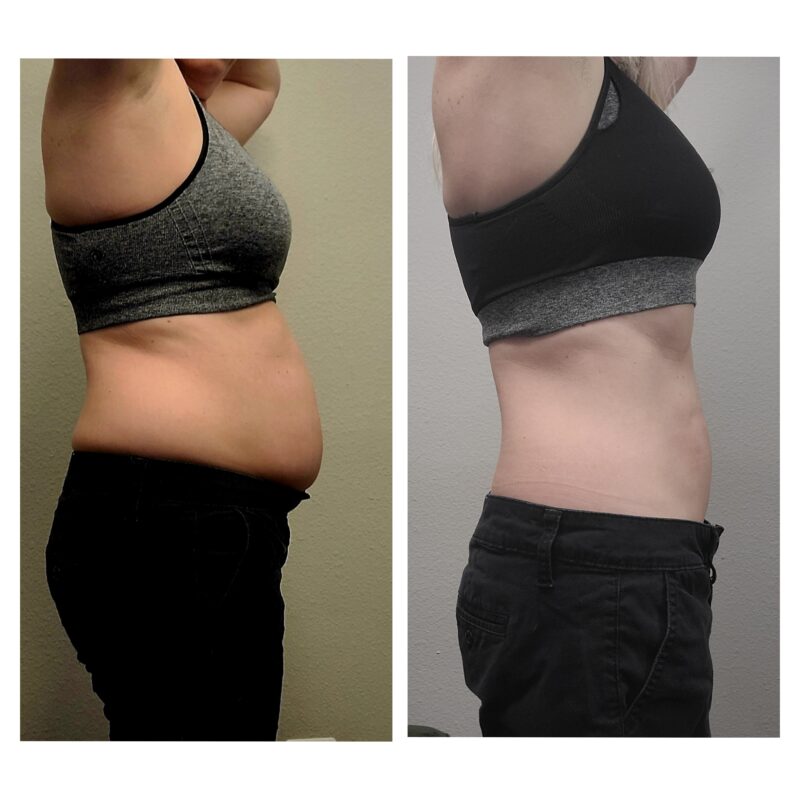 Weight loss from using Semagultide