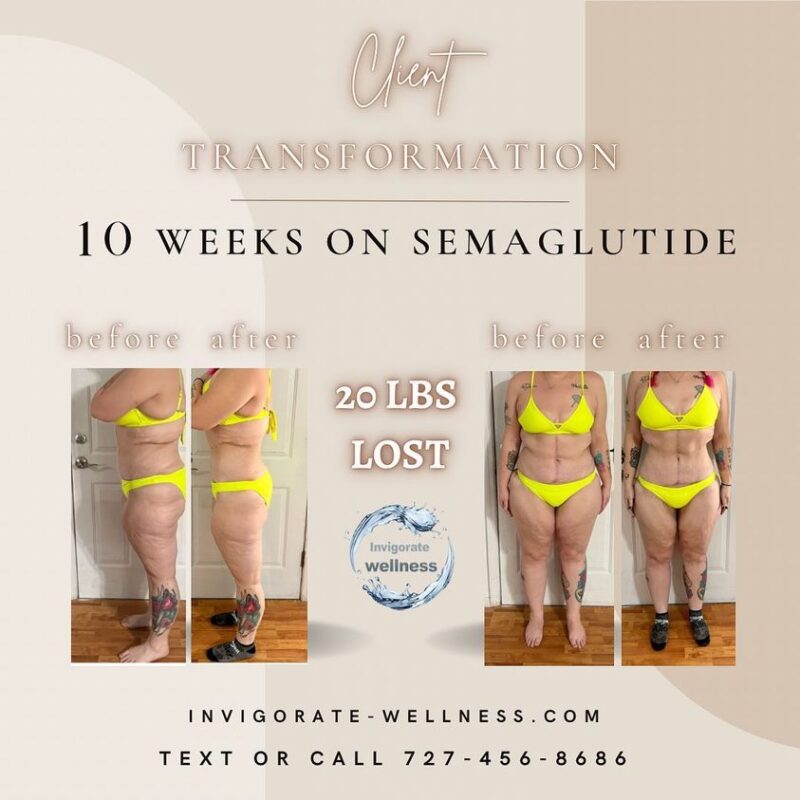 Semaglutide weight loss results of 20lbs before and after pictures
