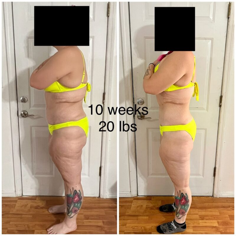 A picture of a client who lost weight on Semaglutide.